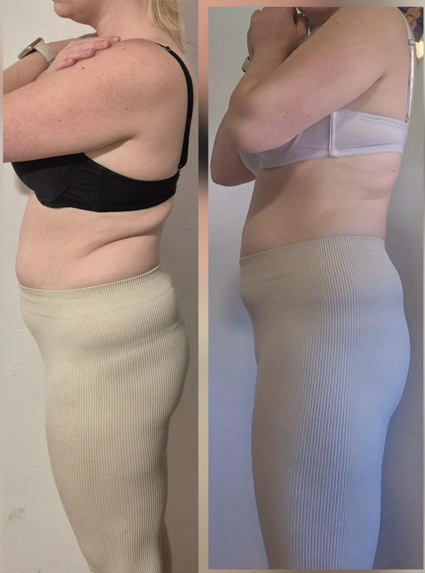 Vorher / Nachher Transformation