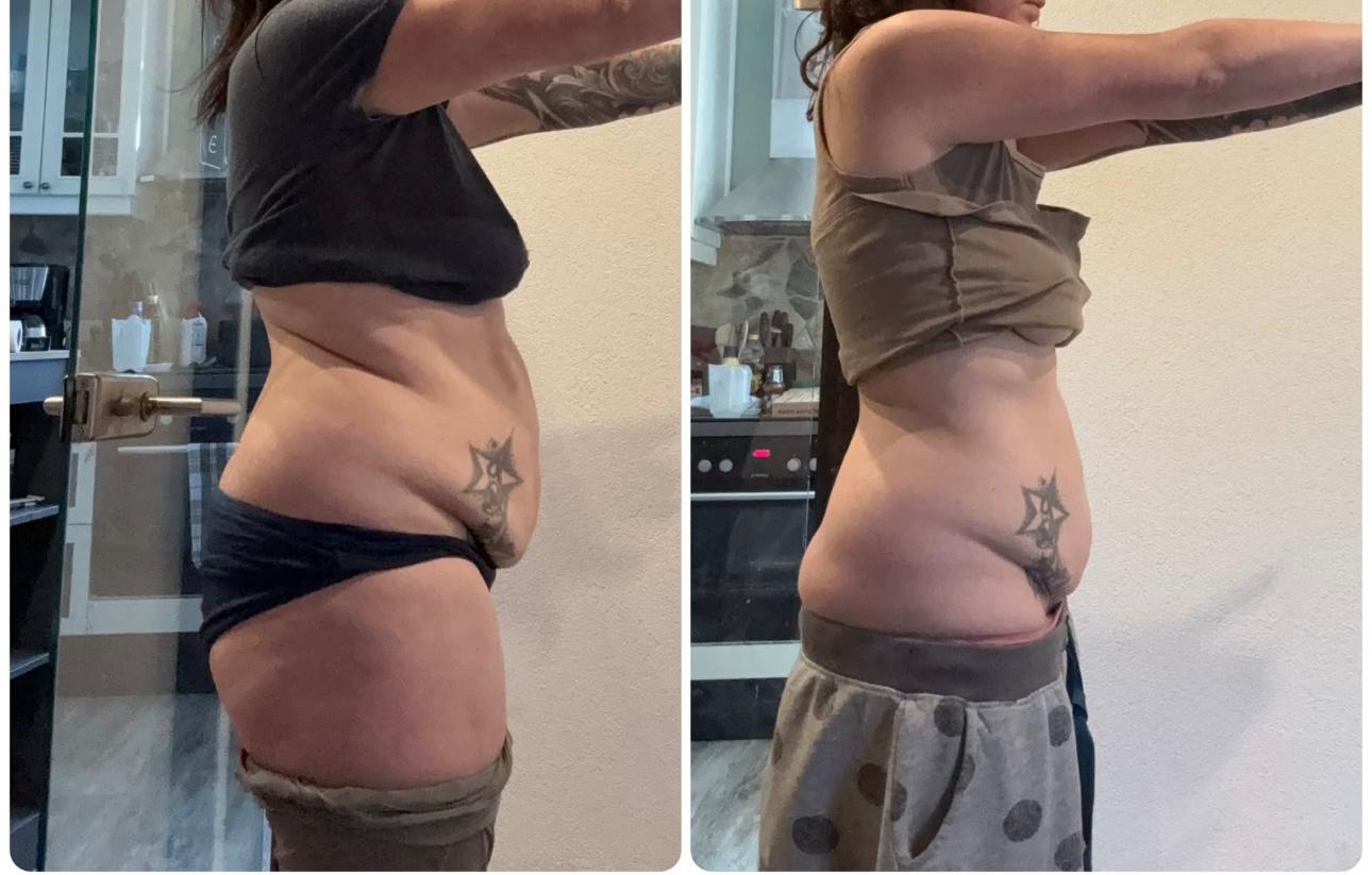 Vorher / Nachher Transformation